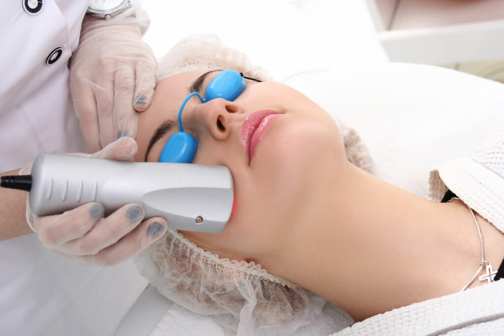 How Laser Therapy Can Be The Best Treatment for Hyperpigmentation patient spots